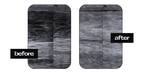 Echo voor en na lasertherapie — springpaard